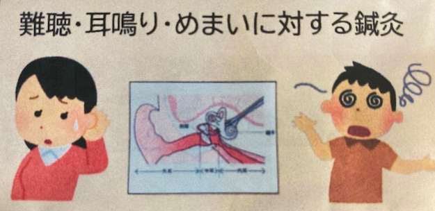 難聴・耳鳴り・めまいに対する鍼灸